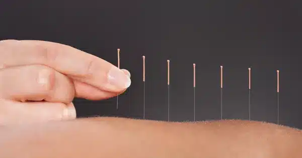 How do I get more acupuncture clients?